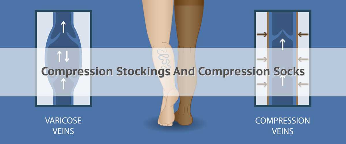 Talking About Graduated Compression Sock and Stocking｜SUNPOLAR